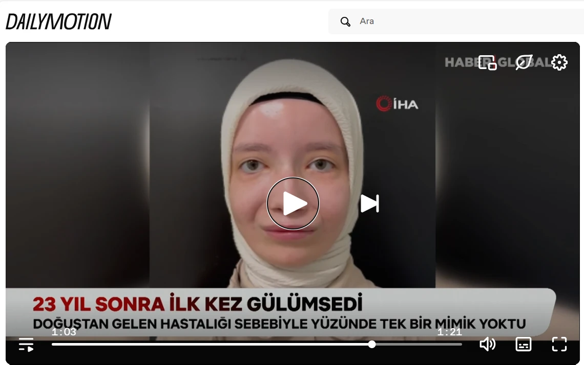 Yüz ve Gülümse(yebilme)  